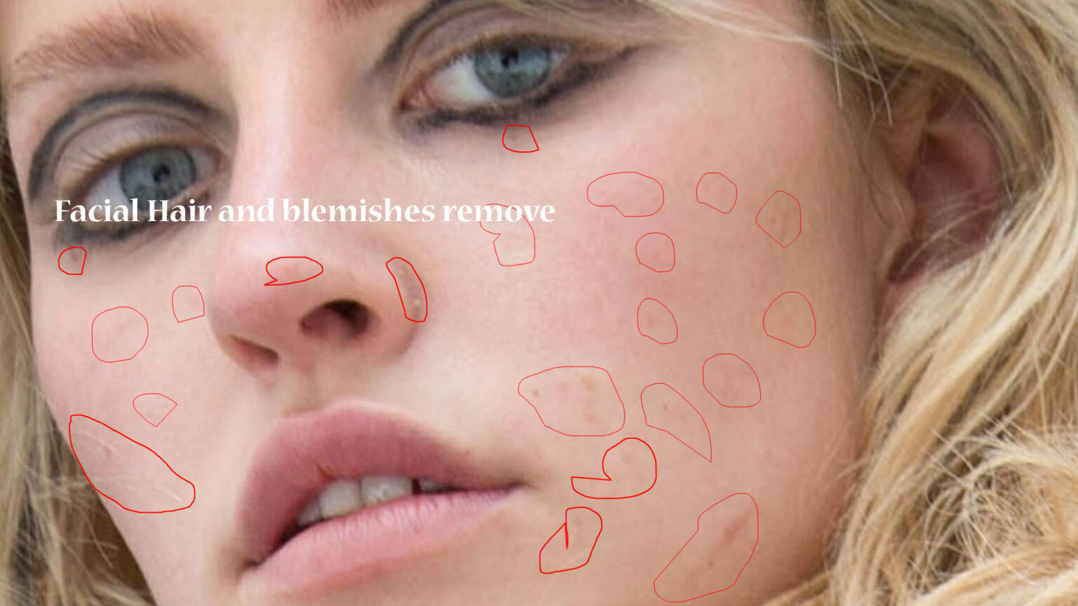 Skin Blemishes and Facial Hair Removal – Clip and Touch